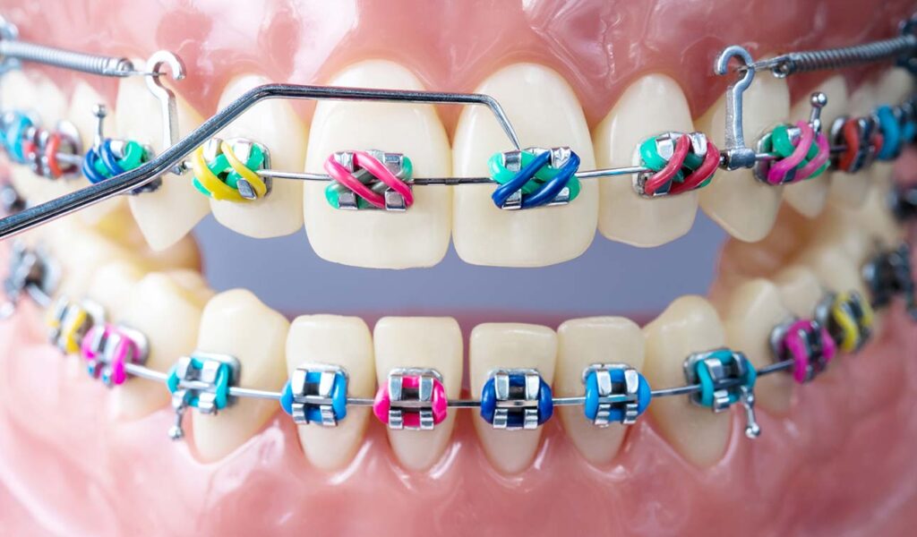 orthodontics